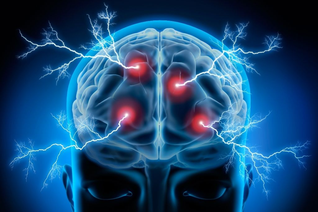 A brain showing the effects of drug addiction - Which Rehab